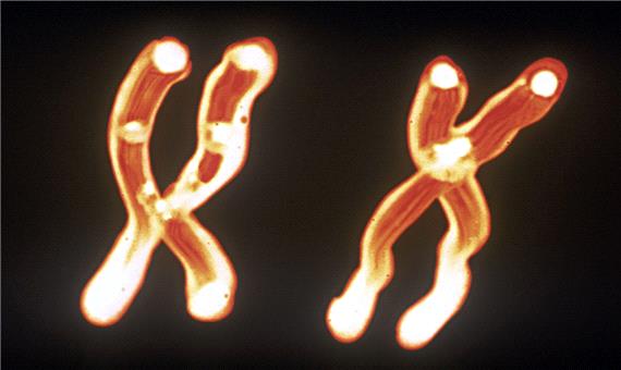 یکی از دلایل مرگ‌ومیر بالای مردان بر اثر بیماری قلبی کشف شد: از بین رفتن کروموزوم Y