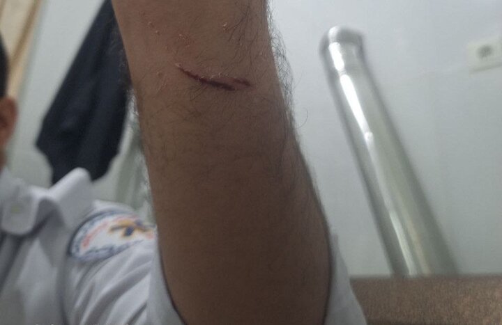 حمله به امدادگر اورژانس ۱۱۵ در کردستان توسط فرد بیمارنما