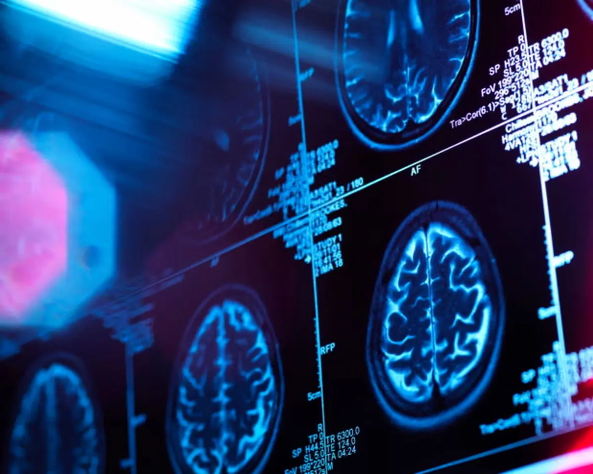 دانشمندان ۵ «دوره» اصلی رشد مغز انسان را شناسایی کردند