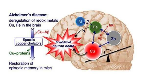 تشدید آلزایمر و نقش بازدارنده ترکیبات معطر گیاهی در مقابله با آن