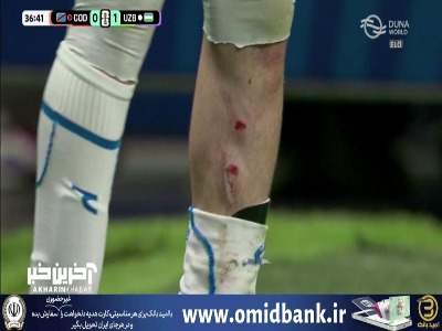 رد استوک‌ بازیکن کنگو روی ساق پای بازیکن ازبکستان!
