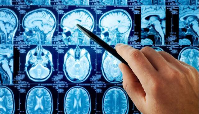 افزایش امنیت هوش مصنوعی در تحلیل MRI مغز با راه حل پژوهشگران دانشگاهی